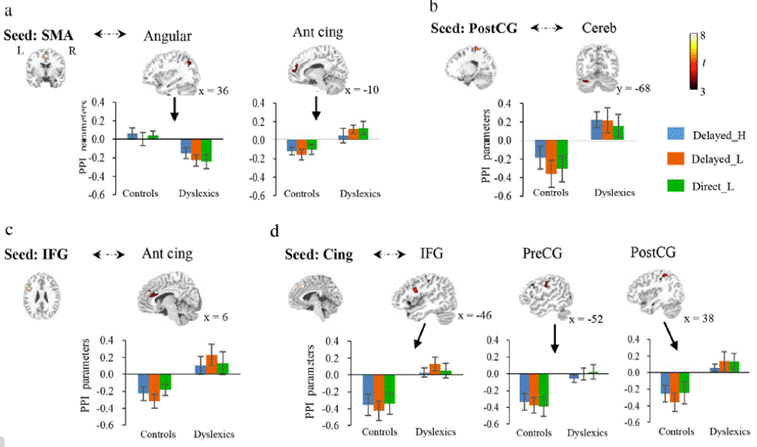 /private/var/mobile/Containers/Data/Application/14F29CD8-CD8B-4AE5-AC25-E7C76515B4F0/tmp/insert_image_tmp_dir/2022-05-23 23:19:43.327000.png2022-05-23 23:19:43.327000