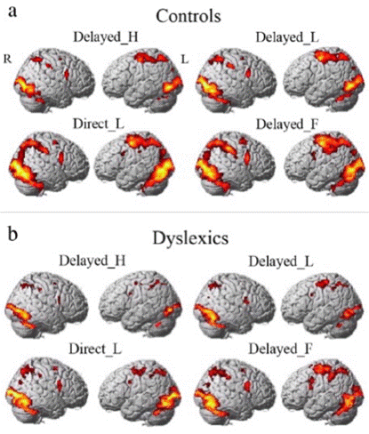 /private/var/mobile/Containers/Data/Application/14F29CD8-CD8B-4AE5-AC25-E7C76515B4F0/tmp/insert_image_tmp_dir/2022-05-23 23:11:45.550000.png2022-05-23 23:11:45.550000